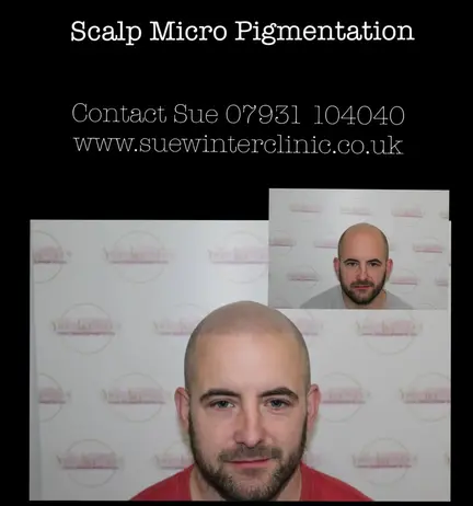 SMP Northampton SMP Northampton