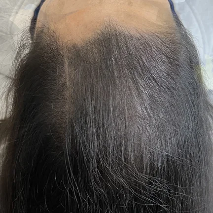 This is her after 3 sessions 